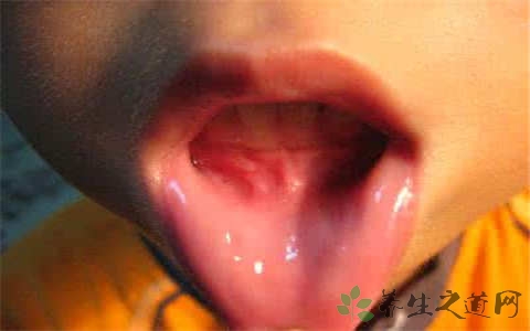 舌癌的症状