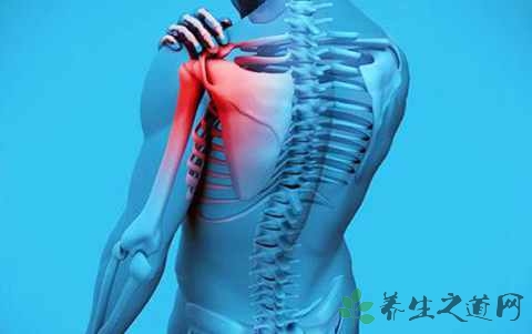 肩关节酸痛是怎么回事